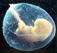 Human unborn baby in the amniotic sac. Photo courtesy Eden Communications ©