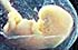 Human fetus - click here to learn more.