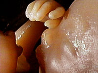 >Human fetus. Photo copyrighted. Courtesy of Films for Christ.