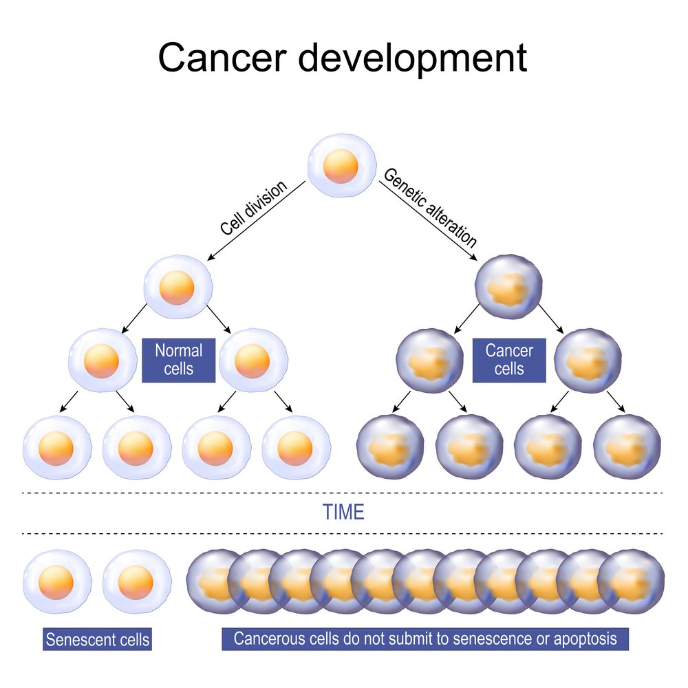 Cancer development illustration